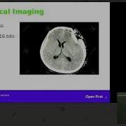 The Rise And Fall And Rise Of JPEG2000 Currently A Niche Codec Recent Enhancements To The JPEG 200