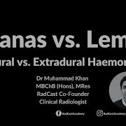 RadCast Case Bananas Vs Lemons Subdural Vs Extradural Haemorrhage Medicine Radiology Radcast