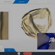 Model Scan With Primescan