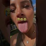 Does She Have Tongue Cancer
