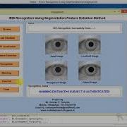 Matlab Code For Iris Recognition Using Segmentation And Feature Extraction