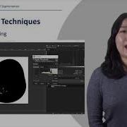 4 4 Image Segmentation Using Thresholding Techniques In Biological Data