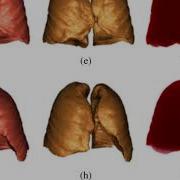 Lung Segmentation With ITK VTK Using Region Growing