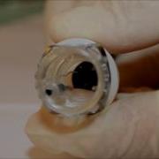 Ovesco FTRD Endoscopic Full Thickness Resection System Set Up