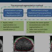 Random Forest Classification And Local Region Based Level Set Segmentation