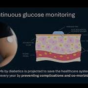 Continuous Monitoring Of Protein Biomarkers Using Implantable Sensors
