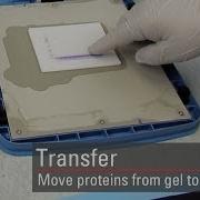 Transfer Proteins To The Membrane For Western Blot Analysis