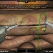 Innovation In Suturing