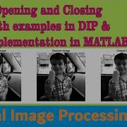 Opening And Closing With Examples In DIP And Its Implementation In MATLAB Morphological Image