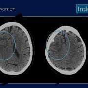Case Review Of Neuroradiology Course Sample