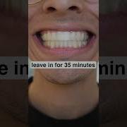 How To Whiten Your Teeth At Home