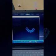 Infinity With Python 2023 Python Python3 Pythonprogramming Pythontutorial Pubgmobile Java