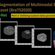 233 Semantic Segmentation Of BraTS2020 Part 2 Defining Your Custom Data Generator