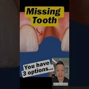 3 Options For Replacing A Missing Tooth Dentist Explains Dentallan Dentist Shorts