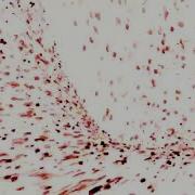 FLASH WARNING Creeds Push Up Luminatix Remix