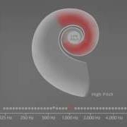 Sound Stimulates The Cochlea MED EL