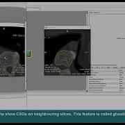 MeVisLab Tutorials Contours Contour Generation And Ghosting