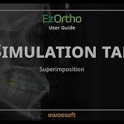 EzOrtho Superimposition