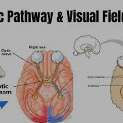 The Optic Pathway Visual Field Defects Medical 3d Animation Learn Biology With Aliya
