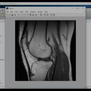 Matlab Based Digital Image Processing Projects Ideas