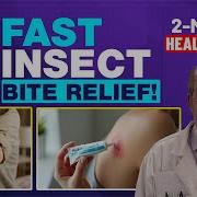 How To Stop Bug Bites From Itching Fast