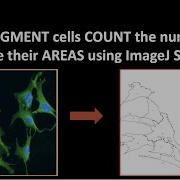 How To SEGMENT Cells And COUNT The Numbers And MEASURE Their AREAS Using ImageJ Software