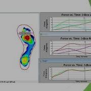 Gait Assessment In A Standard Clinic Room With MobileMat By Tekscan