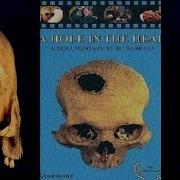A Hole In The Head Trepanation Documentary Part 2