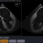 VIST One TEE The Most Sophisticated Real Time Ultrasound Simulation