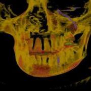 CuVol RayVol Video 4