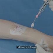 BD Nexiva Single Port Closed IV Catheter Insertion Techniques