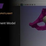 Total Hip Replacement Model In Simpleware