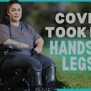 I Caught COVID 19 Lost My Limbs BORN DIFFERENT