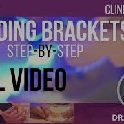 Bonding Brackets Step By Step With Dr Nina Yu Full Video