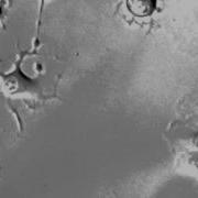 Migrating Neuronal Cells