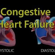 Congestive Heart Failure CHF Left Sided Vs Right Sided Systolic Vs Diastolic Animation