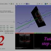Python Interact PyCharm Debug 3D Slicer Pipeline 3D Slicer Extension Development Tutorial 02