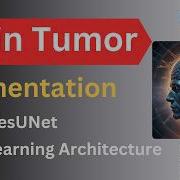 MRI Brain Tumor Segmentation Using ResUNet Deep Learning Architecture