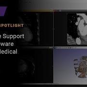 4D Image Support In Simpleware ScanIP Medical S 2021 06