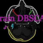 Revolutionary DBSCAN Brain MRI Segmentation See Algorithms Think Like Neurologists