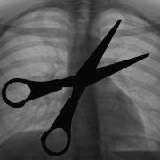 When Surgery Tools Are Left Behind