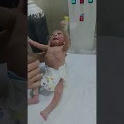Newborn Baby Checking Moro Reflex Newbornbaby Neonatologist Cutebaby