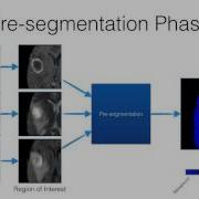 RSNA 2016 ITK SNAP Training Automatic Segmentation