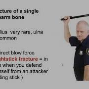OrthoTips 6 Upper Limb Fractures Part 2 2