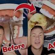 Instant Fake Teeth In SECONDS Orthodontist Reacts