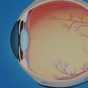 Laser Iridotomy For Glaucoma