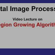 L57 Region Growing Algorithm Digital Image Processing AKTU