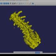 DICOM Processing