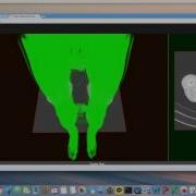 WebGL Volume Rendering Dicom