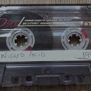 Pulse FM And Impact Radio Acid Breakbeat From 1993 Raw Cassette Rip